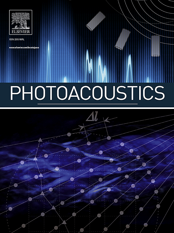 Go to journal home page - Photoacoustics